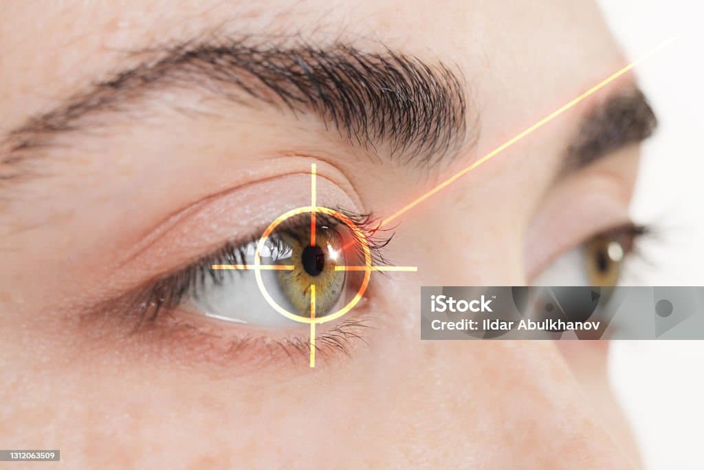 Laser Treatment