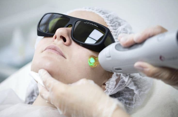 Laser Treatment